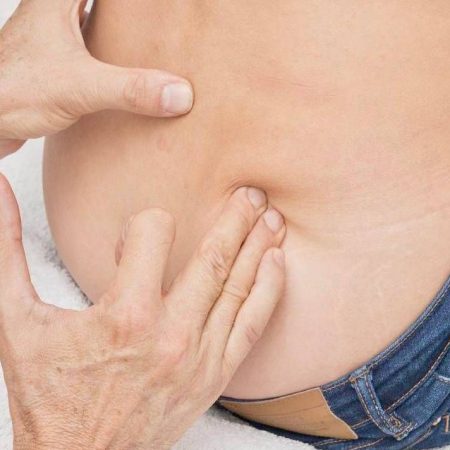 ¿Por qué salen las hernias y cuantos tipos hay? – El Sol de Toluca